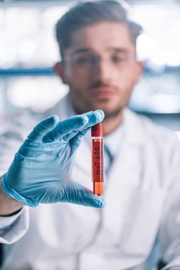 selective focus of immunologist holding test tube with red liquid 