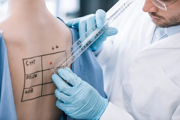 Cropped View Bearded Allergist Holding Ruler Patient Marked Back — Stock Photo, Image