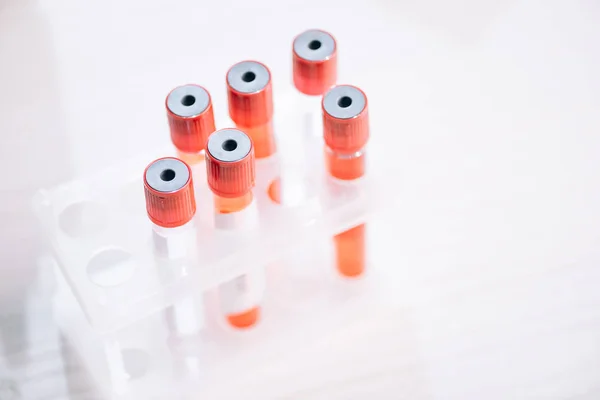 Selective Focus Glass Test Tubes Samples — Stock Photo, Image