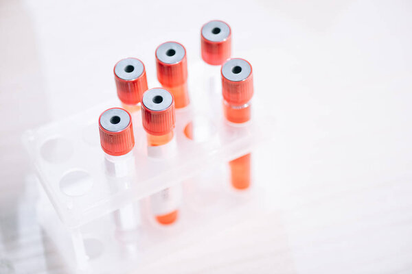 selective focus of glass test tubes with samples 