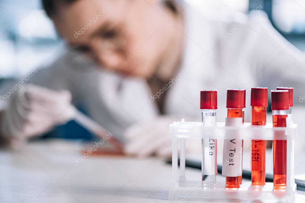 selective focus of glass test tube with letters near immunologist  