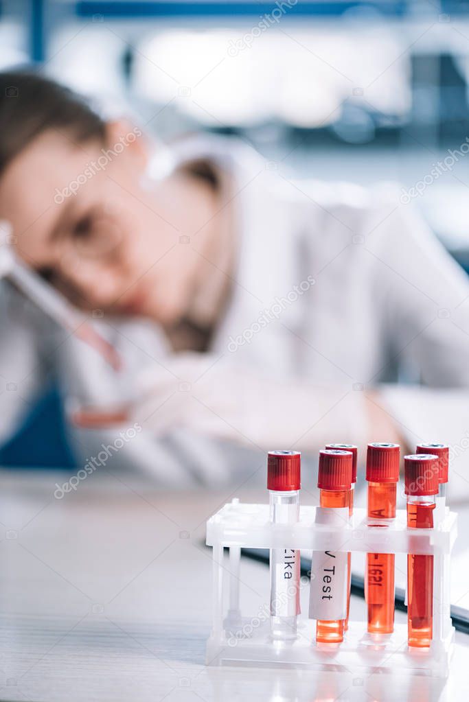 selective focus of glass test tube with lettering near immunologist  