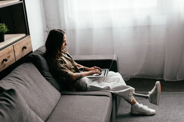 Side View Woman Leg Prosthesis Using Laptop Sofa Living Room — Stock Photo, Image