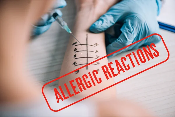 Cropped View Allergist Holding Ruler Marked Hand Woman Allergic Reactions — Stock Photo, Image