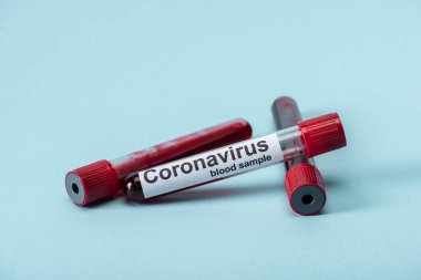 Kan örnekleri ve mavi harflerle işaretlenmiş koronavirüs test tüplerinin seçici odağı 