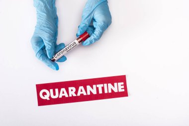 Doktorun lateks eldivenli üst görüntüsü beyaz harflerle izole edilmiş, karantina yakınlarında kan örneği içeren test tüpü tutuyor. 