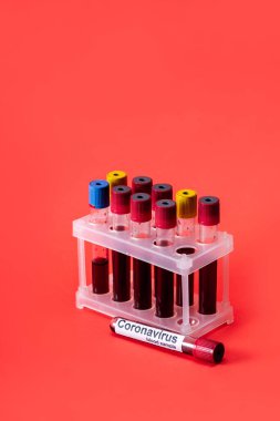 Kırmızı harflerle yazılmış koronavirüslü kan örnekleriyle test tüpleri. 