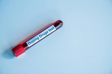 Kan örneğiyle test tüpünün üst görüntüsü ve mavi üzerine doping ilacı test harfleri. 