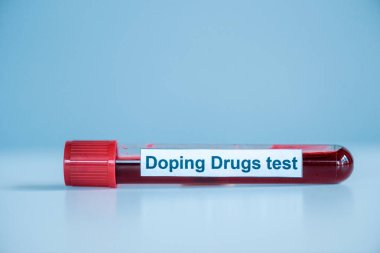 Örnek ve doping ilaçlarıyla test tüpü mavi üzerine test harfleri 