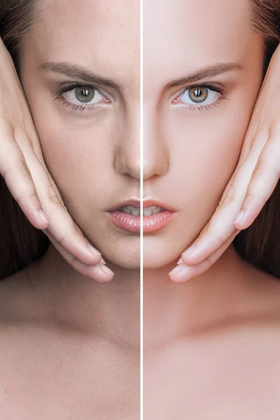 Girl before and after skin care — Stock Photo