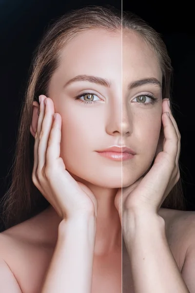 Girl before and after skin care — Stock Photo