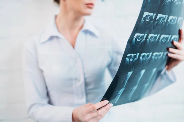 Cropped shot of female doctor examining mri scan — Stock Photo