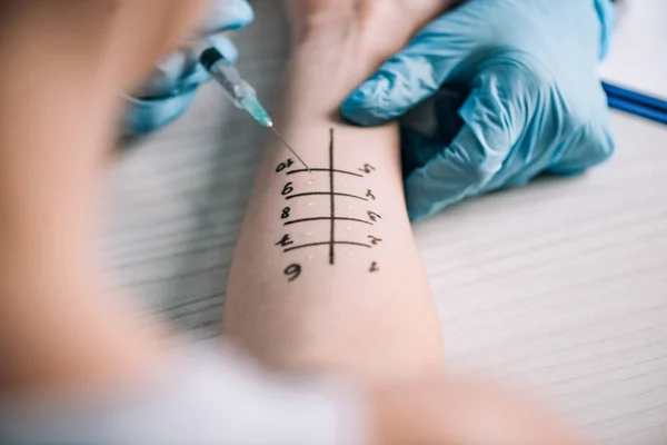 Cropped view of allergist holding syringe near woman while doing allergy test in clinic — Stock Photo