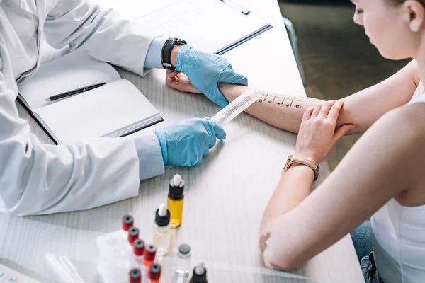 Allergologe hält Lineal in der Nähe markierter Hand der Frau — Stockfoto