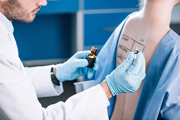 Cropped view of bearded allergist holding pipette near woman with letters on marked back — Stock Photo