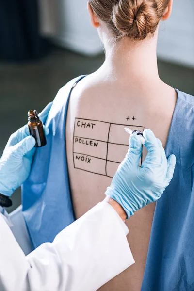 Cropped view of allergist holding pipette near woman with letters on marked back — Stock Photo