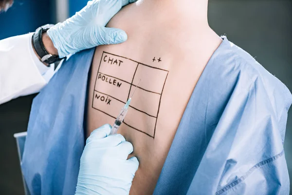 Ausgeschnittene Ansicht eines Allergologen, der Pipette in der Nähe einer Frau hält, mit Buchstaben auf dem markierten Rücken — Stockfoto