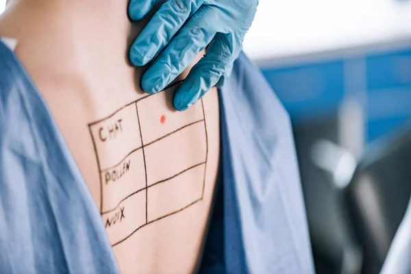Cropped view of allergist touching back of woman with lettering and mark — Stock Photo