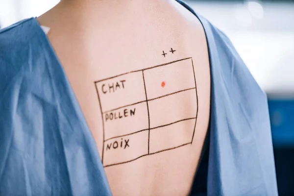 Ausgeschnittene Ansicht einer Frau mit Schriftzug und Markierungen auf dem Rücken — Stockfoto