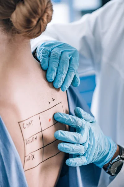 Ausgeschnittene Ansicht des Allergologen, der den Rücken des Patienten mit Schriftzug und Markierung berührt — Stockfoto