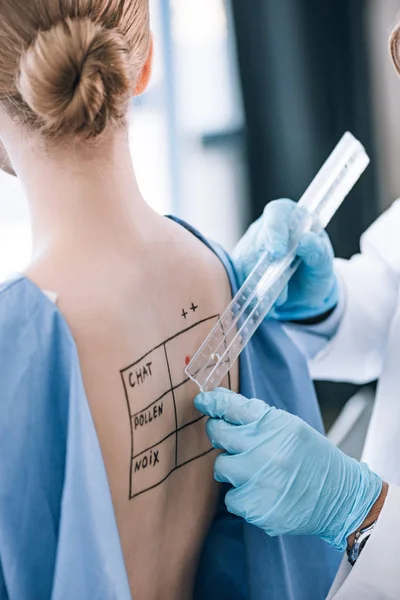 Cropped view of allergist holding ruler near woman with marked back — Stock Photo