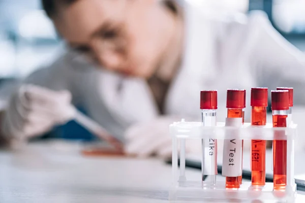 Selective focus of glass test tube with letters near immunologist — Stock Photo