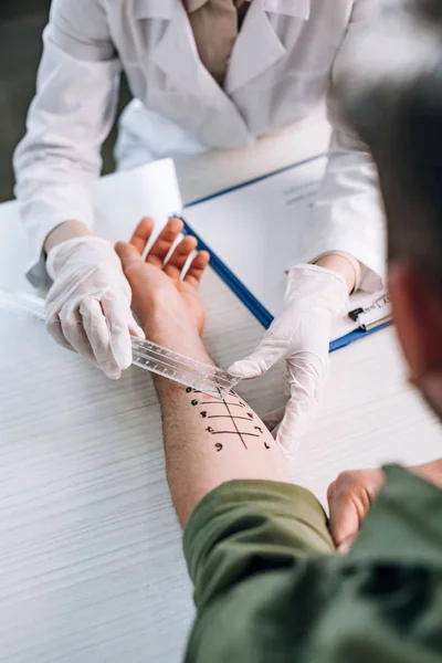 Overhead of allergist in latex gloves holding ruler near marked hand on man in clinic — Stock Photo