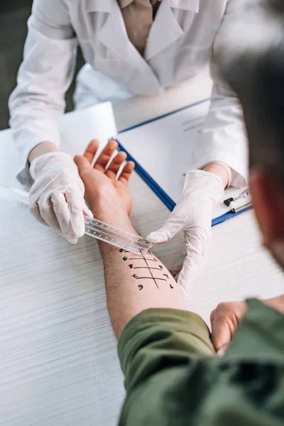 Tête de l'allergologue dans des gants en latex tenant la règle près de la main marquée sur l'homme à la clinique — Photo de stock