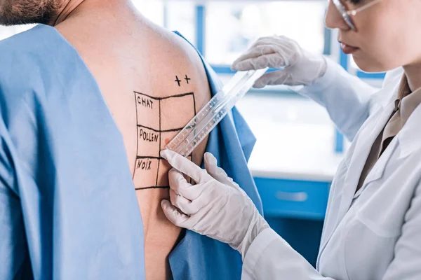 Cropped view of allergist holding ruler near man with marked back — Stock Photo