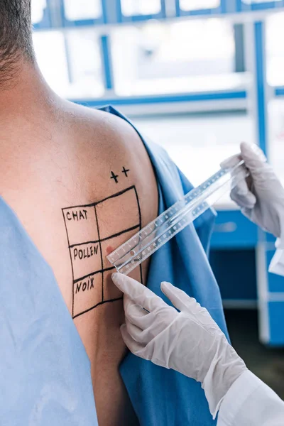 Cropped view of allergist in latex gloves holding ruler near man with marked back — Stock Photo