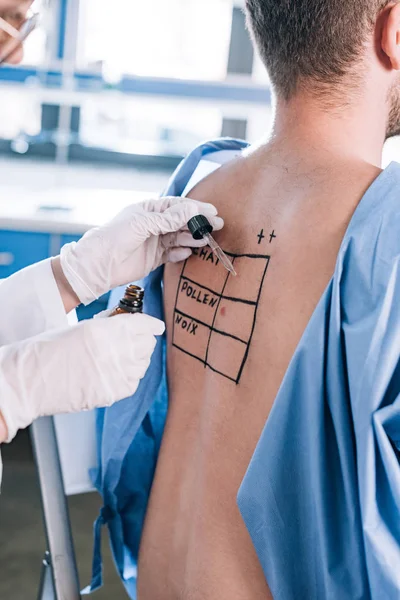 Vue recadrée de l'allergologue tenant la pipette et la bouteille en verre près de l'homme avec le dos marqué — Photo de stock