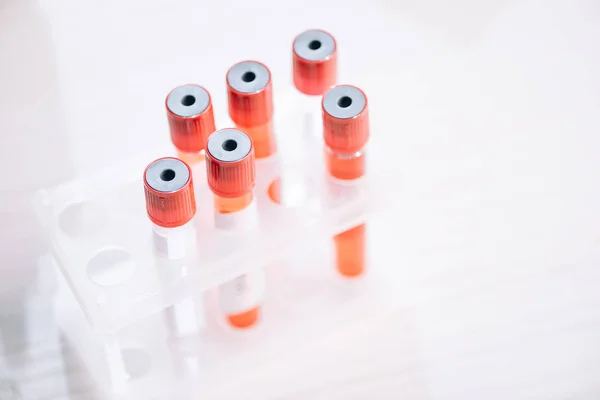 Selective focus of glass test tubes with samples — Stock Photo