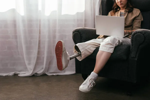 Cropped view of woman with prosthetic leg working at laptop in armchair — Stock Photo