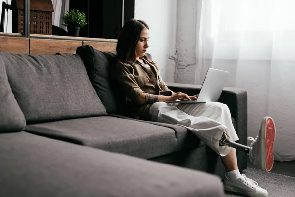 Молодой фрилансер с протезом ног работает за ноутбуком на диване в гостиной — стоковое фото