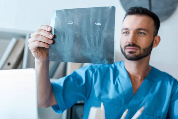 Selective focus of handsome orthopedist looking at x-ray — Stock Photo