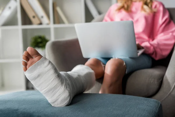 Vue recadrée de la femme blessée travaillant à domicile avec un ordinateur portable — Photo de stock