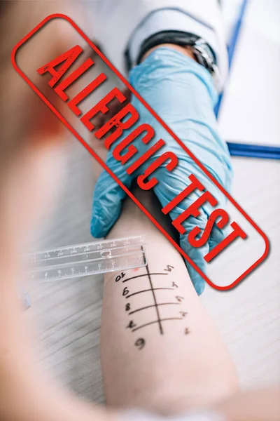 Cropped view of allergist holding ruler near marked hand of woman with allergic test illustration — Stock Photo