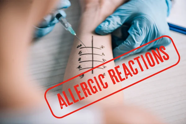 Cropped view of allergist holding ruler near marked hand of woman with allergic reactions illustration — Stock Photo