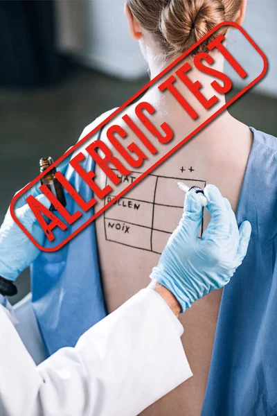 Visão recortada de alergista segurando pipeta perto da mulher com letras em marcado de volta com ilustração teste alérgico — Fotografia de Stock
