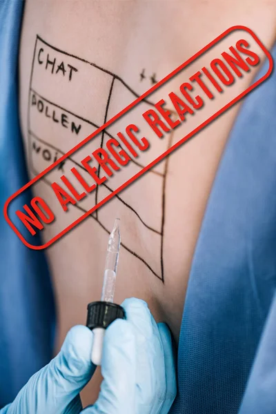 Foco seletivo do médico segurando pipeta perto da mulher com letras nas costas marcadas sem reações alérgicas ilustração — Fotografia de Stock