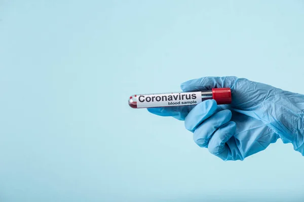 Cropped view of scientist in latex glove holding test tube with blood sample isolated on blue — Stock Photo