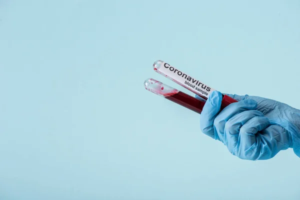 Cropped view of scientist in latex glove holding test tubes with blood samples isolated on blue — Stock Photo