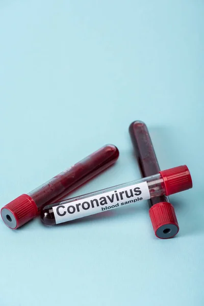 Tubos de ensayo de vidrio con muestras de sangre y letras de coronavirus en azul - foto de stock
