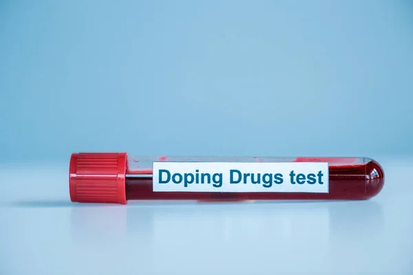 Éprouvette avec échantillon et drogue dopante lettrage test sur bleu — Photo de stock