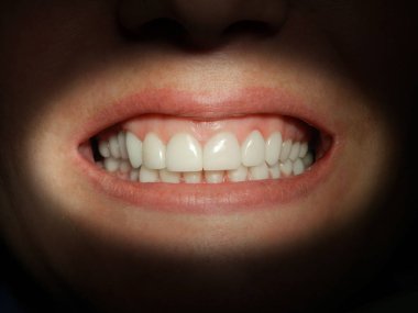 Bir diş kliniğinde hastanın ağzını kapat.