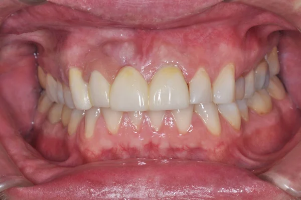 Primer plano de la boca de un paciente en una clínica dental —  Fotos de Stock