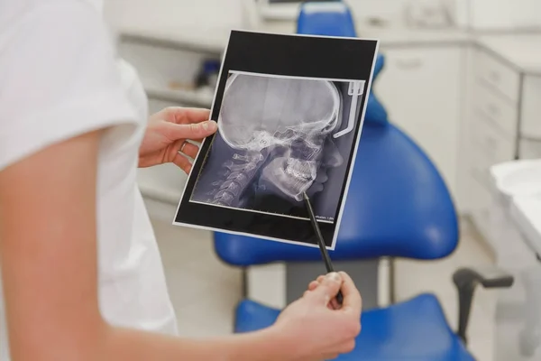 Kvinnliga tandläkare innehar en röntgen bild av en mänsklig skalle från en profil i tandläkarens — Stockfoto