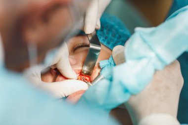 Erkek profesyonel diş hekimi cerrah işlemi gerçekleştirme süreci yakından kadın hastanın dental implant diş Kliniği hafif ofis modern araçlar ekipman ile yükleyin. Kan ve acı yüzünde.
