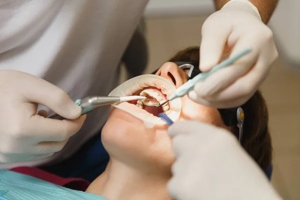 Hazırlama ve seramik diş taç yükleme işlemini kapatın. Erkek profesyonel diş hekimi diş Kliniği hafif ofis modern araçlar ekipman ile kadın hastanın tedavisinde yardımcı olur. Açık ağız.