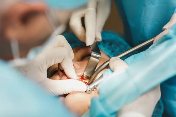 Nära upp processen för manliga professionella tandläkare kirurgen utför åtgärden installera tandimplantat tänder av kvinnlig patient klinik ljus kontor med moderna verktyg utrustning. Blod och smärta i ansiktet. — Stockfoto
